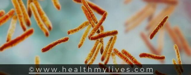 Mycobacterium tuberculosis