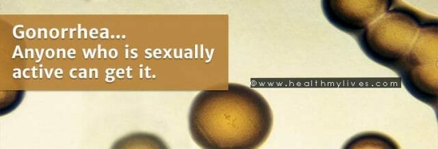 Gonorrhea facts