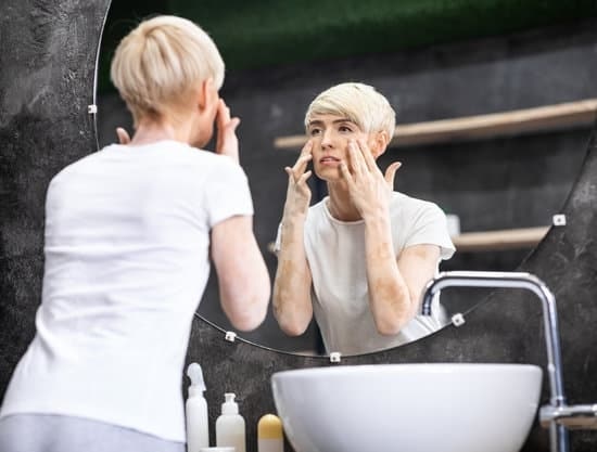Vitiligo prevention